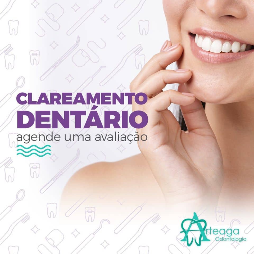 Clareamento Dentário